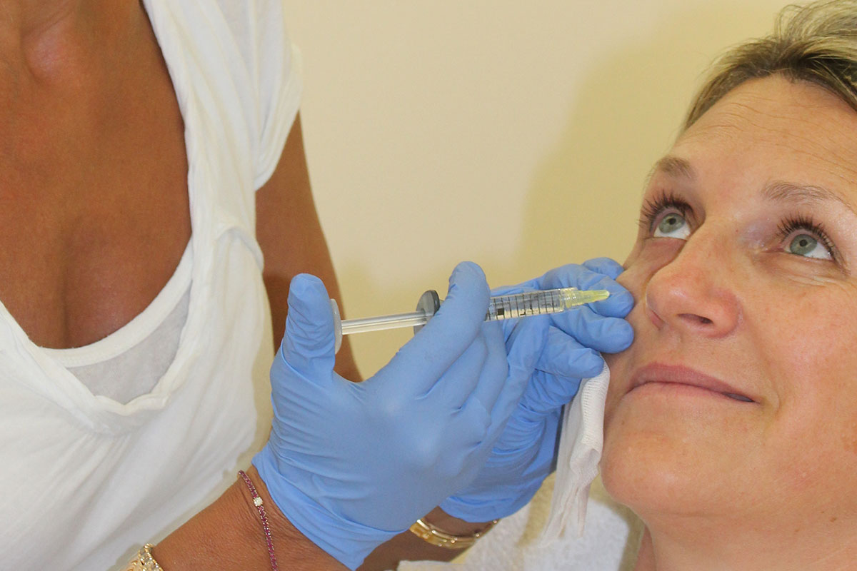 Augenringe behandeln mit Filler bei Dr. Doris Wallentin